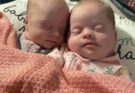 Florida Woman Gives Birth To Rare Set Of Identical Twins With Down Syndrome – Look How Cute They Are..